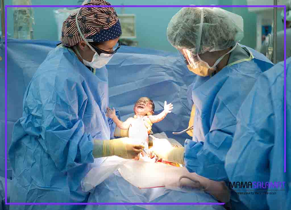 انجام زایمان سزارین تولد نوزاد با عمل جراحی