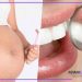 سلامت دهان و دندان در بارداری آیینه دندانپزشکی و شکم خانم حامله