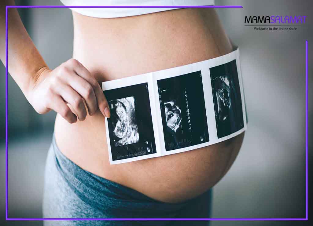 سونوگرافی در بارداری تصویر شکم خانم باردار و سونوگرافی سه بعدی