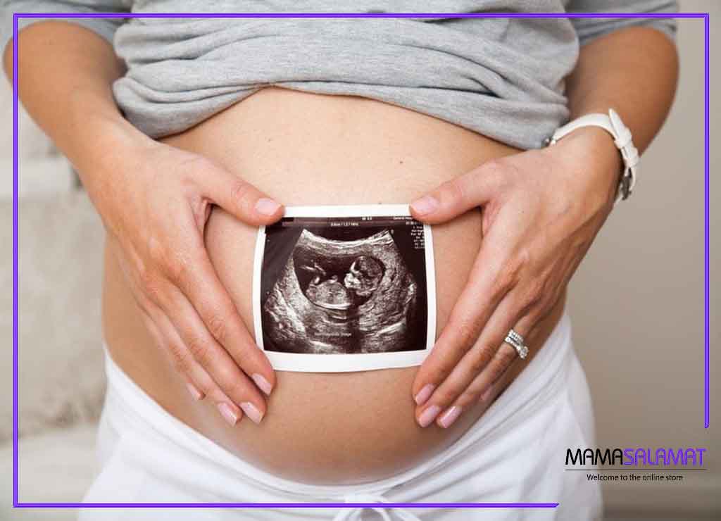سونوگرافی در بارداری تصویر خانم باردار و عکس سونوگرافی