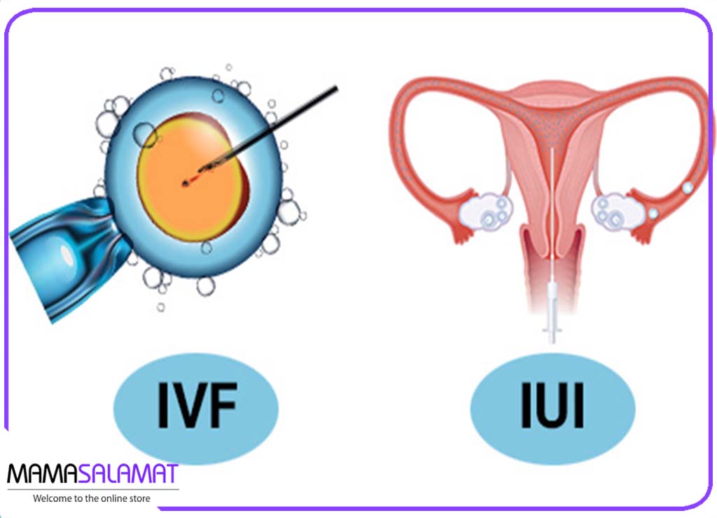 ناباروری تفاوت روش IVF و IUI