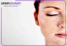 درمان لک صورت بعد از زایمان لک صورت و کک ومک