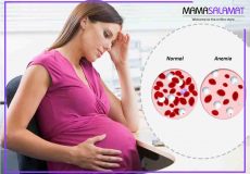 کم خونی در بارداری-کم خونی شدید یا خفیف