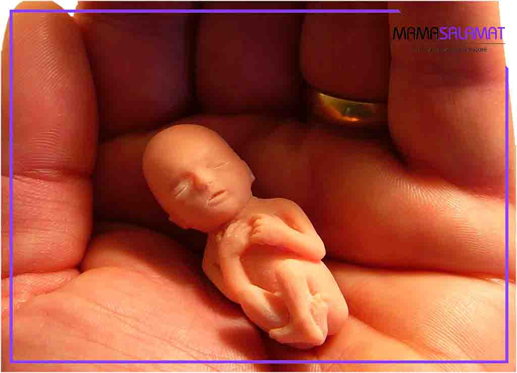 دلایل سقط جنین-سقط جنین به دلیل شرایط ژنتیکی