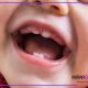 دندان درآوردن تصویر دندان های کودک