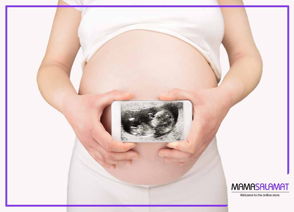 هماتوم در بارداری تصویر مادر باردار و عکس سونوگرافی